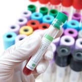 Careful review of medical evidence during a wrongful death case.